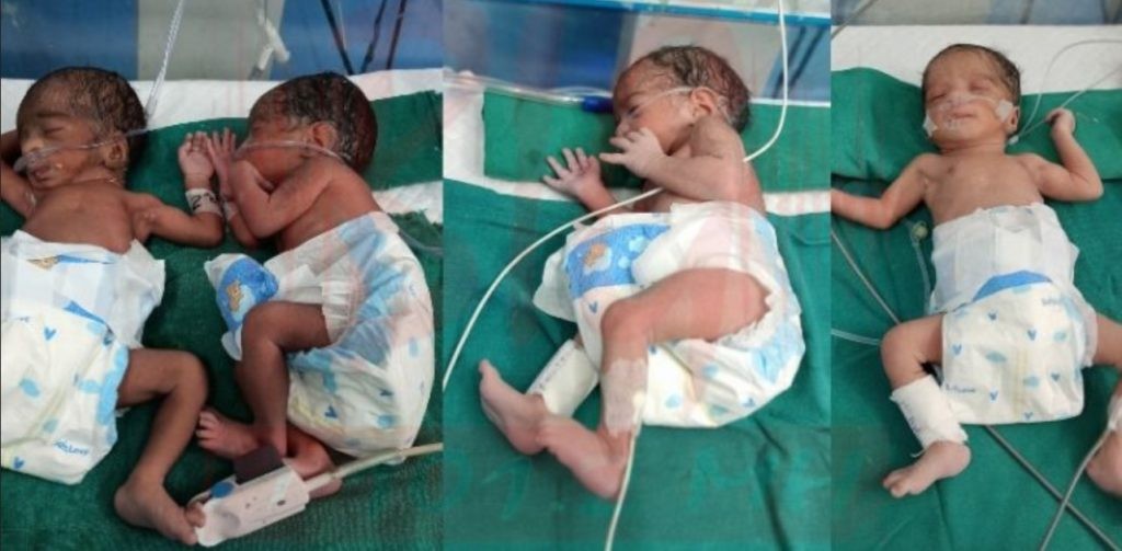 २६ वर्षीया महिलाले एकै पटकमा चार सन्तानलाई जन्म दिईन